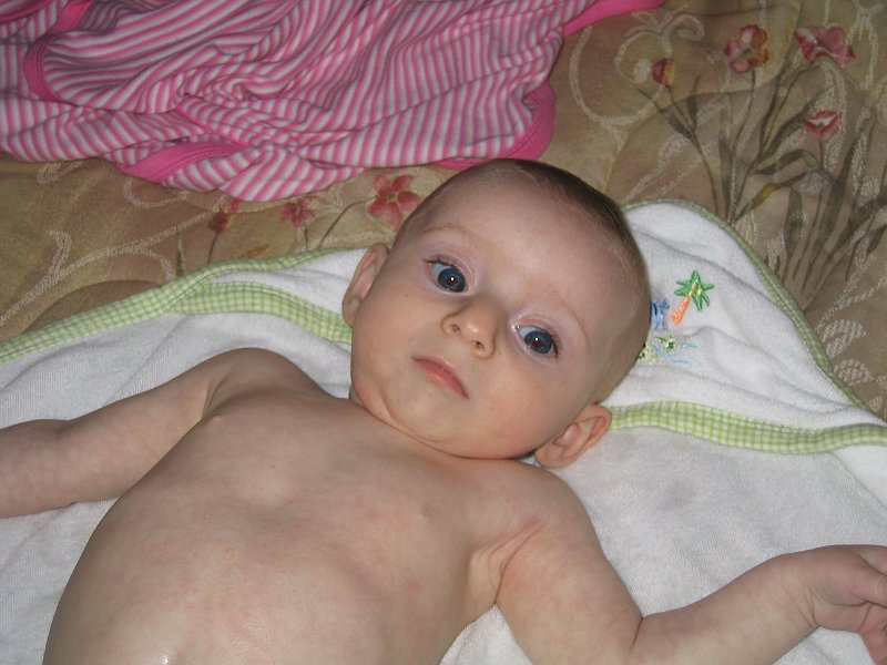 baby9 0086